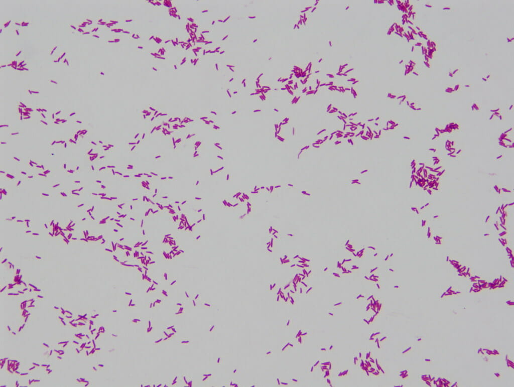 E. coli from pigeons