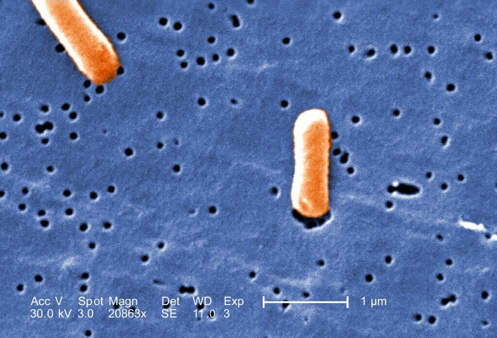 Salmonellosis from rats